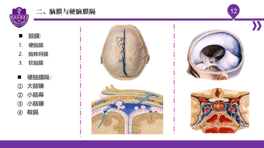 004脑室、脑膜、脑池、脑脊液_14.jpg