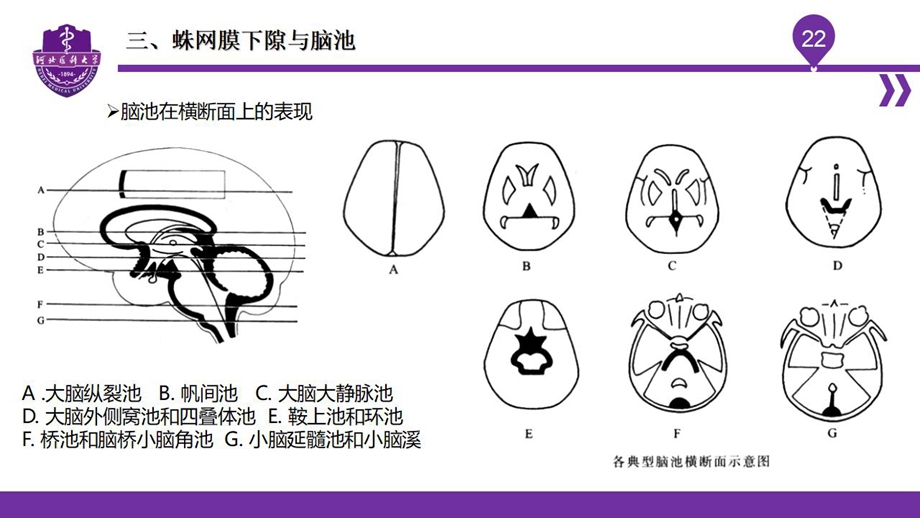 004脑室、脑膜、脑池、脑脊液_24.jpg