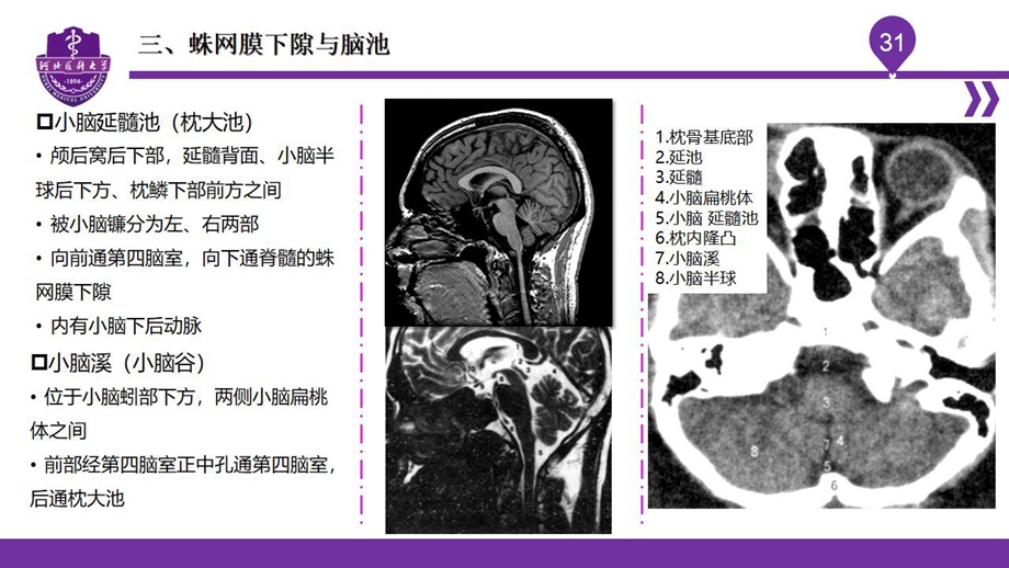 004脑室、脑膜、脑池、脑脊液_34.jpg